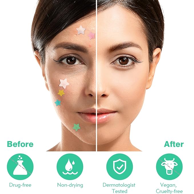 Pimple Patches For Face 240 Counts Hydrocolloid Acne Patches Colorful Zit Patches Acne Dots Blemish Patches with Salicylic Acid Tea Tree Oil Calendula Oil 3 Sizes Acne Patches Star Pimple Patches