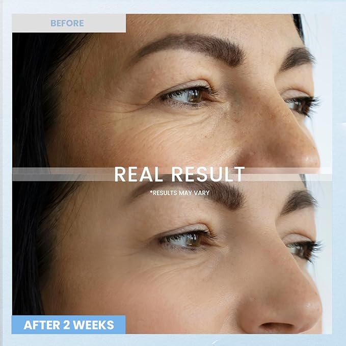 Retinol Eye Cream for Dark Circles: Anti-Wrinkle Under Eye Cream - Night Care Eye Cream Reduces Eye Bags