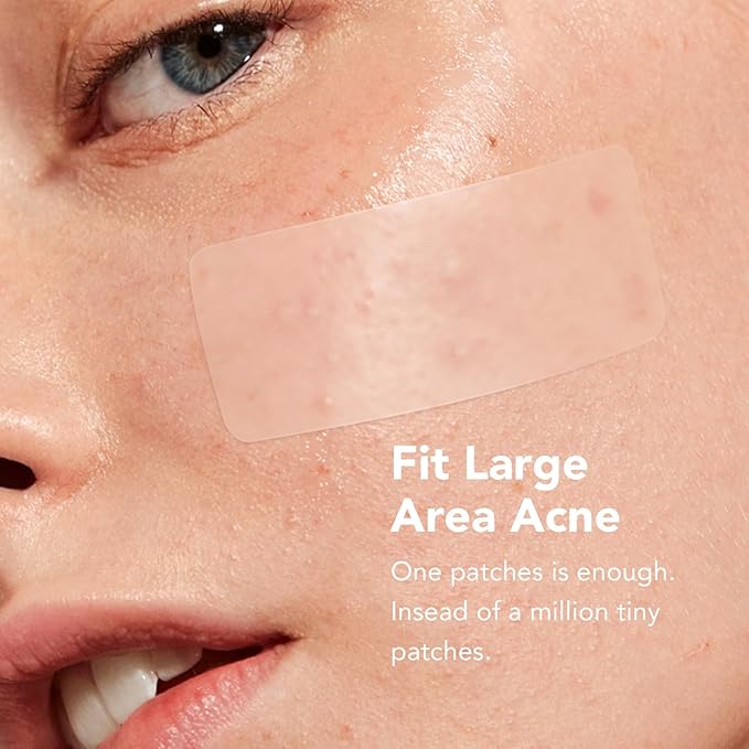 Pimple Patches (6 Sizes 188 Patches), Acne Patches for Large Zit Breakouts, Hydrocolloid Bandages for Face, Chin, Nose, Forehead, Body, Back, Neck & Chest, Round, Rectangle and Square Hydrocolloid