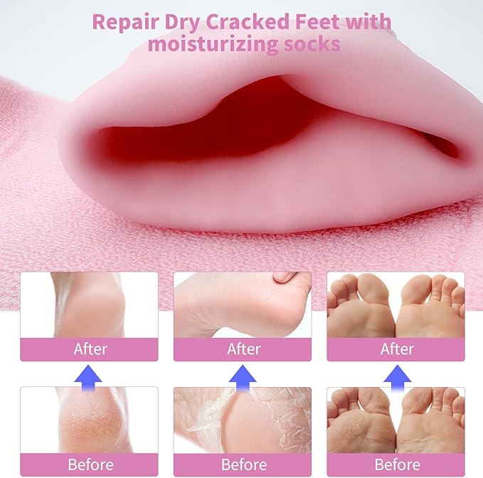 11" Large Silicone Moisturizing Socks for Women - 2Pairs Soft Gel Foot Moisturizing Socks for Dry Cracked Feet