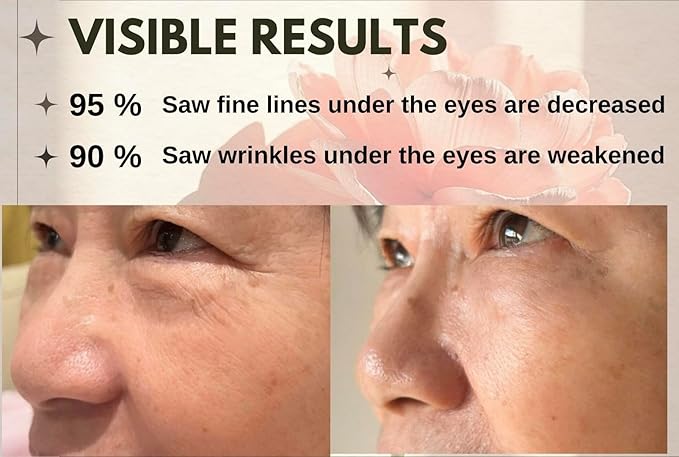 Deep Moisture Anti Aging Firming Eye Cream – USDA Certified, Plump & Hydrate , Smooth Wrinkles, Fine Lines,Dark Circles under eye treatment, Eye Cream for Puffiness and Bags Under Eyes 15ml