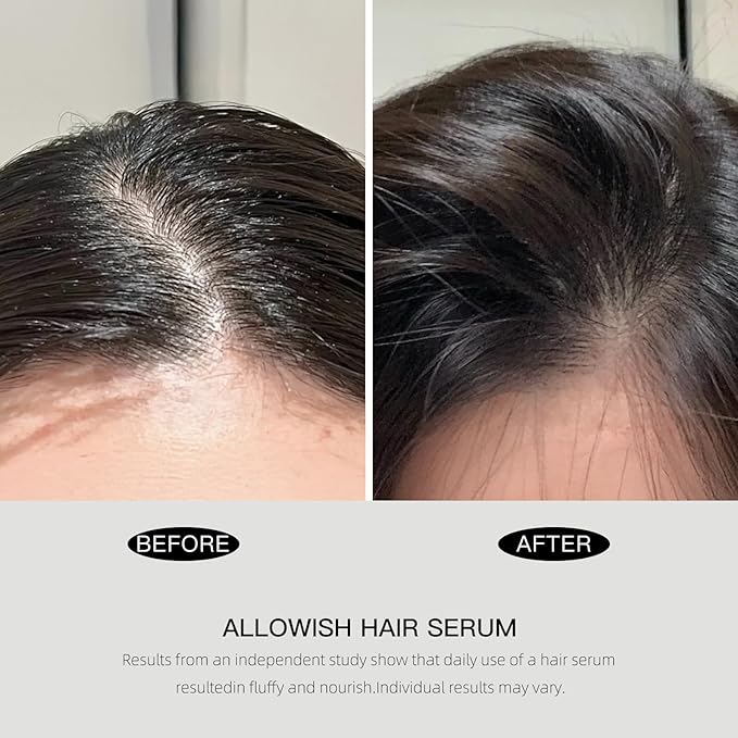 Advanced Hair Serum - 95 ml Scalp Treatment for Fuller, Nourish, Glossy Hair | Prevents Frizz, Promotes Healthy Scalp & Strengthens Roots, Reduces Oil & Buildup