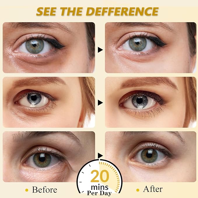 30 Pairs 24K Gold Eye Mask, Reduce Dark Circles, Puffy Eyes, Undereye Bags, Gel Collagen Eye Patches for Reduce Fine Line, Moisturizing Under Eye Gel Pads for Women Men
