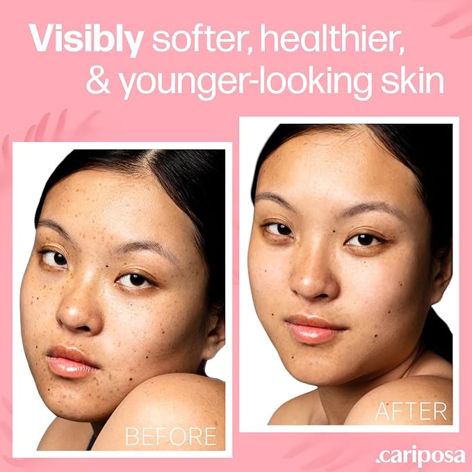 Hyaluronic Acid Serum for Face - Made From Pure Hyaluronic Acid Serum - Hydrating Serum Hyaluronic Acid for Enhanced Skin Texture 1oz