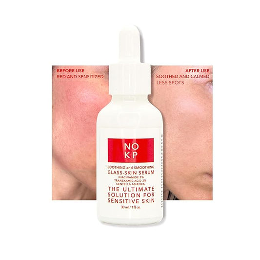 Glass skin anti-redness soothing and smoothing serum for glowy skin, Calming Serum for Face and Body, Relieves skin redness and Rosacea with Centella Asiatica (Tiger grass), aloe, panthenol