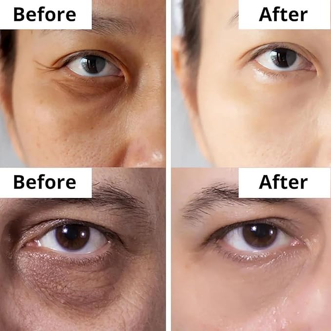 DermaSet Eye Serum with Caffeine and Vitamin C to Improve Fine Line and Dark Circles | 0.51 Fl Oz (Pack of 1)