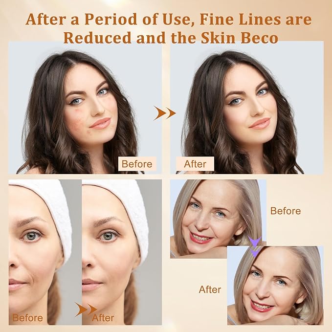 Hotodeal LED Face Mask Light Therapy,3 Colors Light Therapy for Skin Rejuvenation Anti-aging Beauty Red Light Therapy,Silicone Material LED Mask Foldable for Easy Carrying,Leather Version