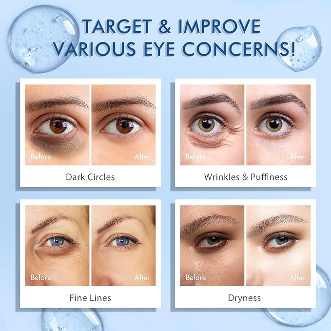 Eye Serum for Dark Circles and Puffiness - 5% Caffeine Under Eye Cream Anti Aging, with Retinol Hyaluronic Acid Niacinamide, Eye Serum for Eye Bags with 360° Eye Roller Ball for Women & Men