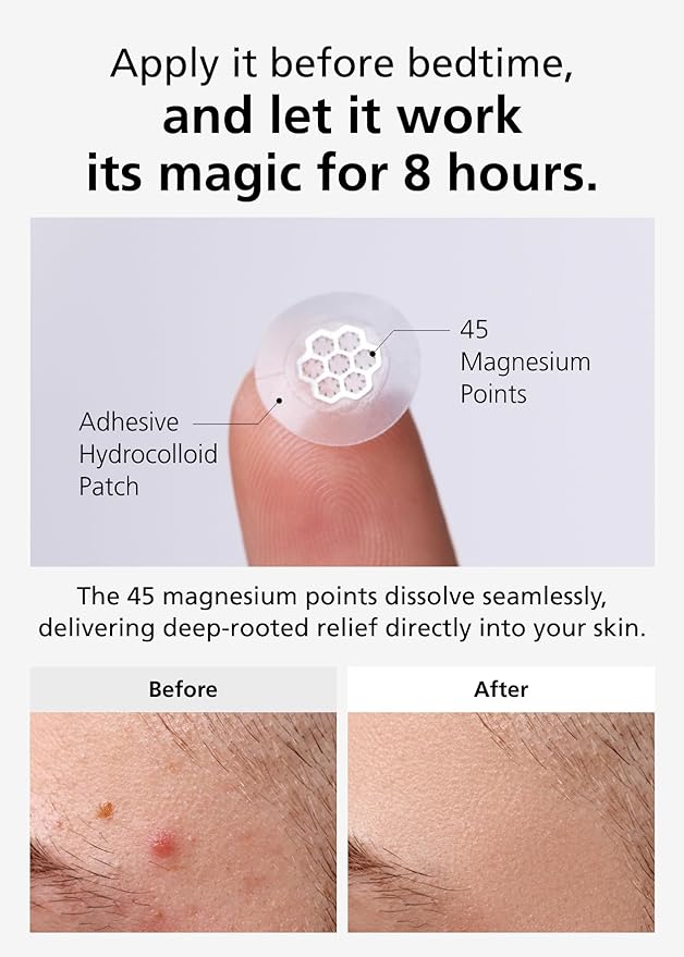 Quick Calming Magnesium Patches(20 patches) with Cica Ampoule - Intensive Care, Pimple patches, Hydrocolloid Band, Zits Spot care Overnight Home Care 2-8 hours, New boxs types