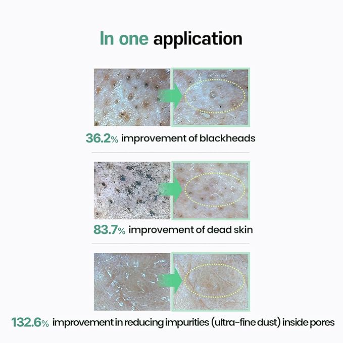 ilso Natural Mild Cleansing Oil/Daily Makeup Blackheads Removal 200mL