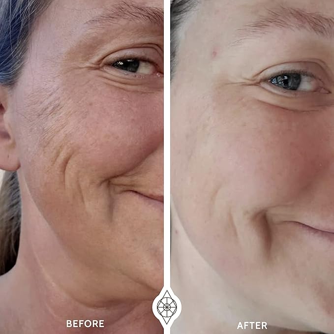 The OMG Blaster 5-in-1 Face Lifting Tool by Ashley Black. Patented Technology for Fine Lines, Wrinkles, Skin Tightening, Face Contouring, Lymphatic Darinage and Temporary Blood Flow