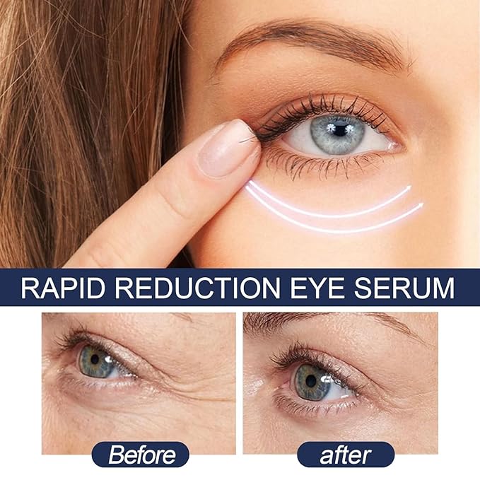 Rapid Reduction Eye Serum - Advanced Formula - Anti Aging Serum Visibly Reduces Under-Eye Bags