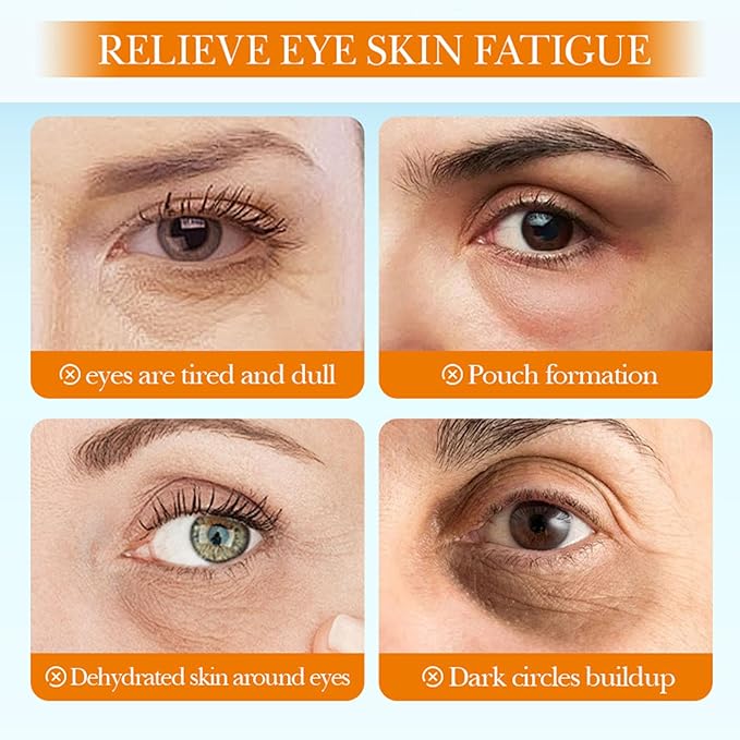 20 Packs steam eye masks for dry eyes，rest self heating eye mask，self warming steam mask，steam eye masks disposable for spa warm compress for eyes travel gifts stress relief