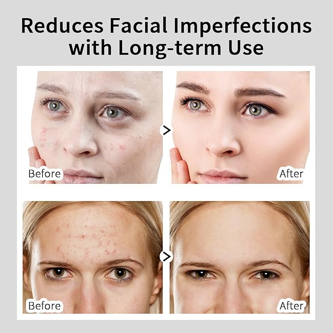 Alpha Arbutin 2% + HA Serum for Anti Aging & Wrinkles, 1 PCS Moisturizing Alpha Arbutin Serum 2% with Hyaluronic Acid, Niacinamide for Acne & Spots, Hyaluronic Acid Essence for Face.