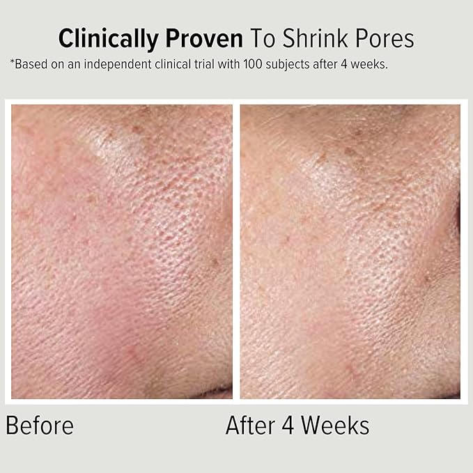 Niacinamide 10% Face Serum with Hyaluronic Acid, 2-in-1 Toning & Hydrating – Shrinks Pores, Reduces Inflammation, and Evenly Tones Skin – Anti-Aging & Hydrating Formula for All Skin Types