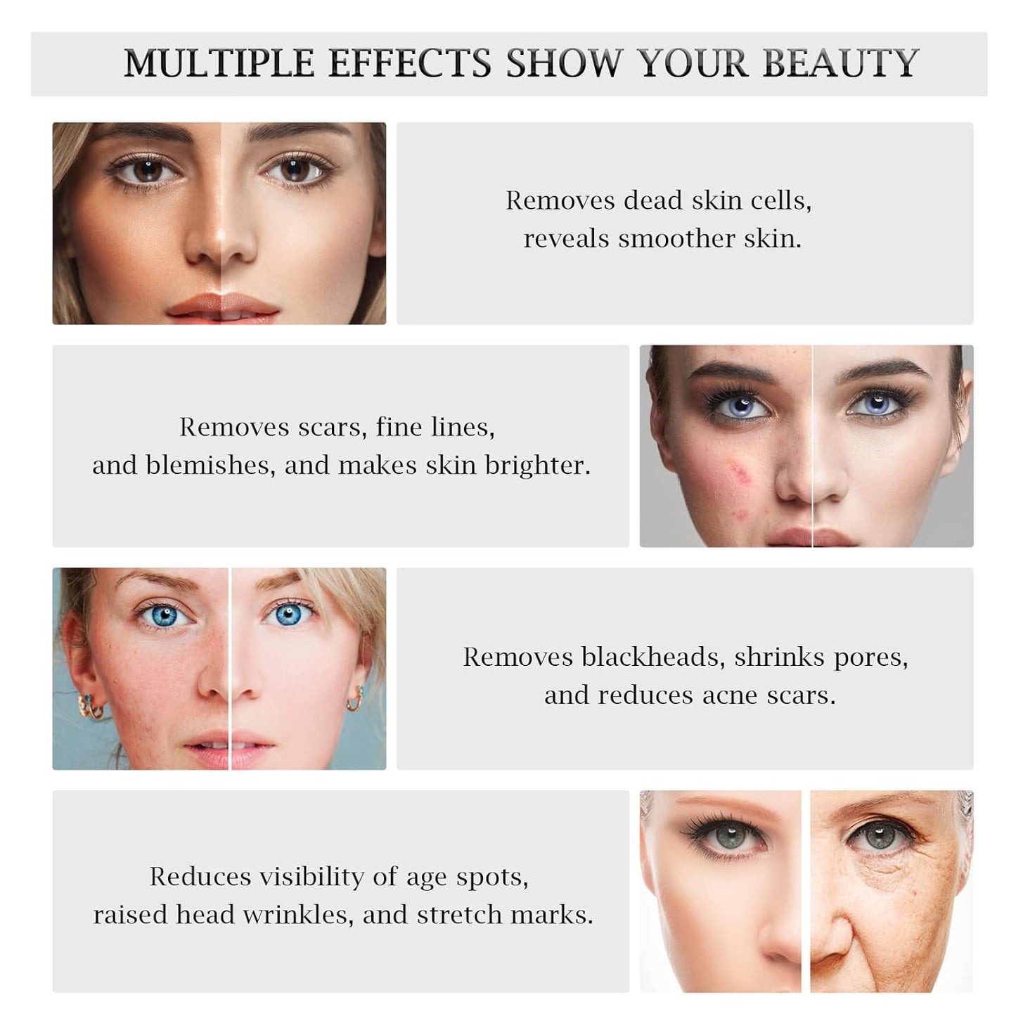 3 in 1 Diamond Microdermabrasion Machine, Professional Microdermabrasion Device with Vacuum Spray, Beauty Facial Skin Care Dermabrasion Equipment for Salon Personal Home Use