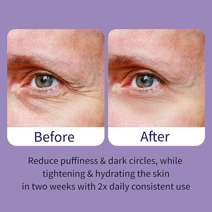 Ebanel Peptides Eye Serum, Dark Circles Treatment for Women and Men, Under Eye Bags Puffiness Remover, Lifting and Firming Serum with Wine and Lavender Extracts