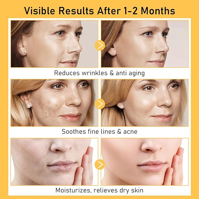 Argireline Serum For Oily Skin, Advanced Anti-Wrinkle Facial Serum For Women, 30 ML/ 1 PCS Moisturizing Argireline 10% Solution For Face, Argireline Peptide.