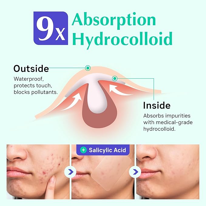 XXL Acne Patches - Hydrocolloid Pimple Covers for Face & Body Breakouts | Cystic Zit Treatment | Vegan (10ct)