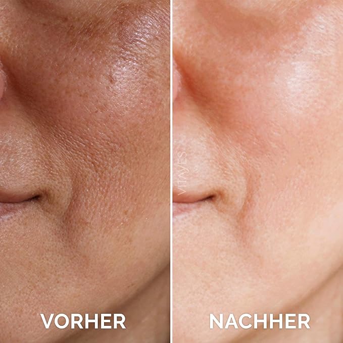 VITAYES Vitamin C Face Serum Anti Aging Serum with Hyaluronic Acid Skin Hydrating & Brightening for Dark Spots, Fine Lines and Wrinkles 1 Oz.