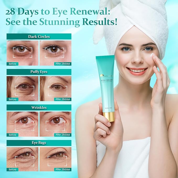 Advanced Eye Cream for Dark Circles - Targeted Solution for Wrinkles, Puffiness, and Firmness - Proven Efficacy with Cynanchum Atratum, and Natural Infusions (30ml)