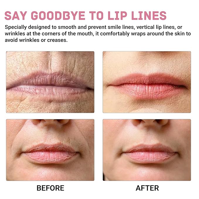 3 Pairs Anti Wrinkle Patches for Lip, Smile Line Patches, Moisturizing and Breathable, for Smoothing Smile Lines and Mouth Corners, Restoring Skin to Firmness and Smoothness