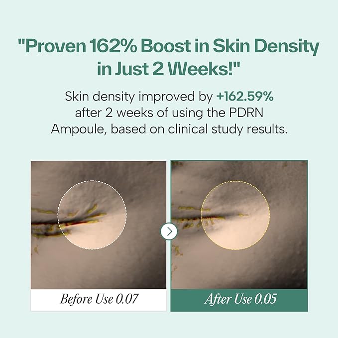 PDRN73 Revitalizing Ampoule – Hydrating & Repairing Serum with 73,000 ppm PDRN, Niacinamide & Peptides for Radiant, Plump Skin – Anti-Aging & Brightening Skincare – 30ml / 1.01 fl.oz