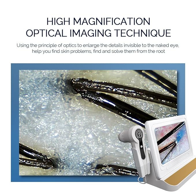 Scalp Analysis Machine, 11 Inch HD Screen Skin Hair Analyzer, Digital Hair Follicle Scalp Detector with 50x/200x DualHeads for Home Salon Use,No APP Needed