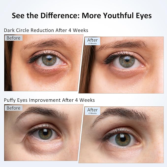 Caffeine Eye Cream for Dark Circles, Puffiness & Puffy Bags - Under Eye Serum with Caffeine, Niacinamide, Hyaluronic Acid, Vitamin E & Peptides, 0.7 Fl Oz (Pack of 1)