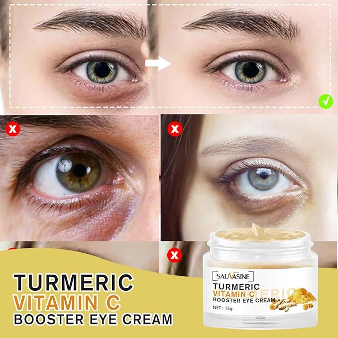 Turmeric + Vitamin C Eye Cream, Turmeric Under Eye Cream for Dark Circles and Puffiness, Anti Aging Cream Correction for Puffy Eye Bags Fine Lines Dark Circles Wrinkles Eye Firming Even Skin Tone