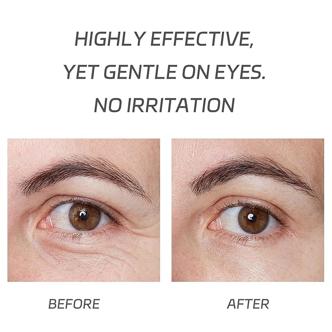 VGO Eye Cream 2% Pro-Xylane Eye Repair Cream for Dark Circles & Puffiness Under Eyes, Pro Xylane + 6D Hyaluronic Acid to Firm Skin, Reduce Wrinkles, Fine Lines, 15g/0.5 Oz