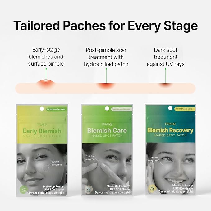 FRANZ - Hydrocolloid Spot Cover for Face, Zit, Blemish - Fast Acting Acne Pimple Patches Extra Adhesion, All Skin Types - Infused with Tea Tree Oil, Calendula Oil