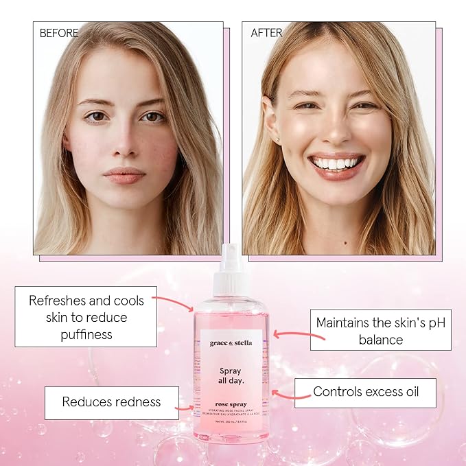 grace & stella Award Winning Rose Water Facial Spray (30ml) - Vegan - Rose Water Spray Toner for Face - Rose Spray Facial Mist - Rosewater Spray Rose Hydrosol