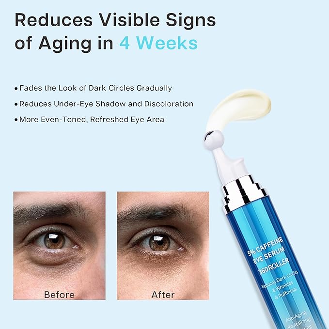 Eye Serum for Dark Circles and Puffiness, 5% Caffeine 8% Retinol Under Eye Cream with Build-In 3D Roller Applicator, Hyaluronic Acid Peptide for Hydration Fine lines Wrinkles, 0.5 fl oz