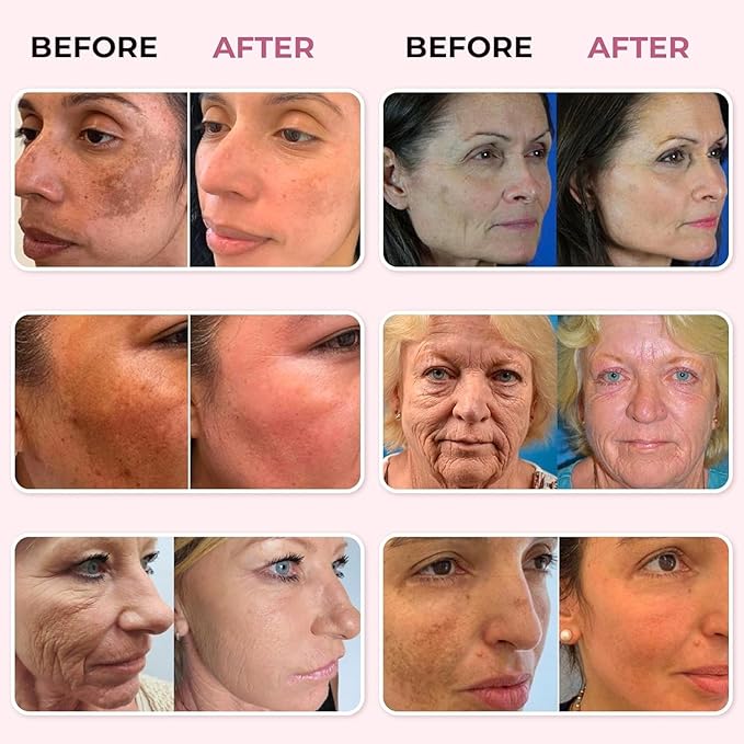 ABERA Saffron Serum For Melasma Treatment, Renewing for Face, Anti-Aging Serum for Fine Lines & Wrinkles, High Potency Saffron Extract, Hydrating Serum, Dark Spot Remover, 1.01 Fl Oz