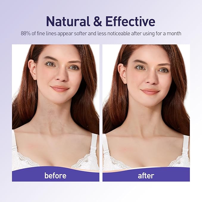 Neck Silicone Wrinkle Patches Reusable for Wrinkles Treatment, Anti Aging Wrinkle Pads Overnight, 2 Patches