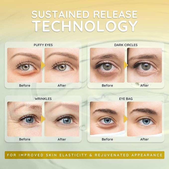 Enaskin Naturals Under Eye Patches for Dark Circles: Premium Gels Pads - Reduce Eye Bags, Wrinkles & Puffy - Skin Treatment Advanced Mask - Anti Aging & Face Moisturizer For Women, 10 Pairs (Black)