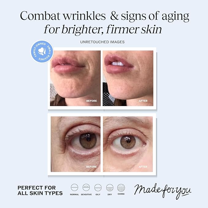 LilyAna Naturals Anti Aging Retinol Face Cream for Women – Wrinkle & Neck Cream for Firming, Retinol Moisturizer for Face with Hyaluronic Acid, Hydrating Night Cream for Fine Lines, Collagen Boost