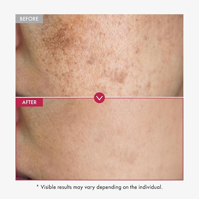 Niacinamide 10% + Tranexamic Acid 4% Serum, Arbutin 2%, Hyaluronic Acid, TXA Facial Serum, Glass Skin, Clarifying, Radiant Complexion with Natural Color, Korean Skin care, 33ml, 1.11 fl.oz.