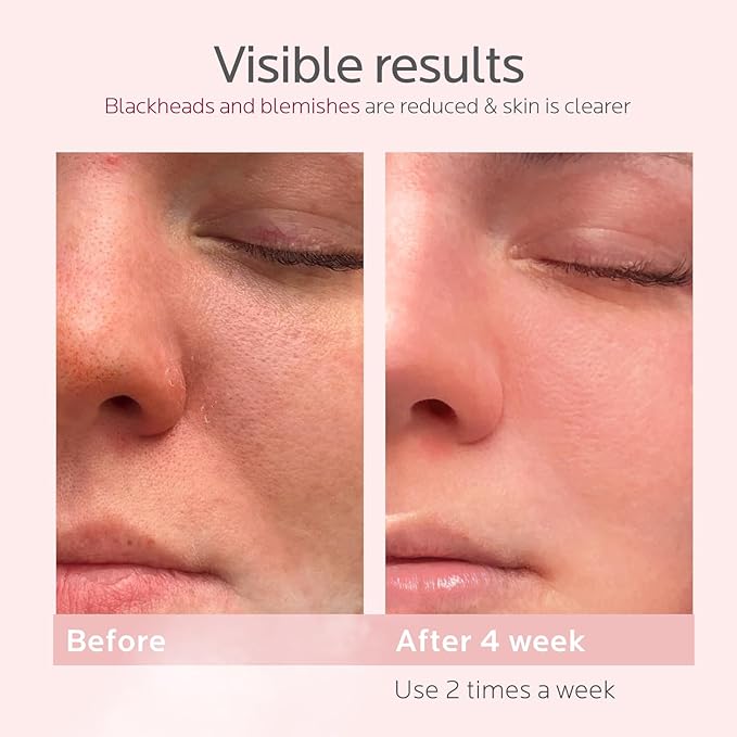 Colorfarm Facial Steamer Nano Ionic: Face Steamer Deep Cleaning Unclogs Pores - Humidifier Warm Hot Mist Home Sauna Spa for Women Men Sinuses Moisturizing