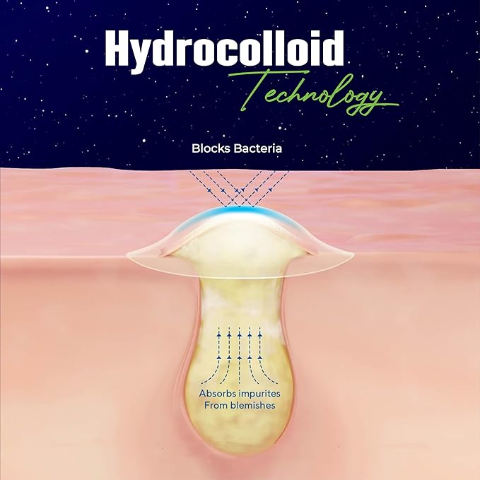 Star Pimple Patches for Face – Hydrocolloid Acne Patches for Quick Zit Relief And Blemishes, Invisible Spot Stickers That Stay All Night, Gentle for All Skin Types, Oil-Free (40 Count)