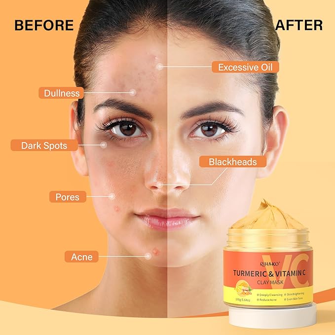 Turmeric Vitamin C Clay Mask| Deep Cleansing Facial Clay Mask for Dark Spots, Dull Skin, Refining Pores and Controlling Oil,Dark Spot Remover for Face,Face Masks Skincare-Gift for Him & Her