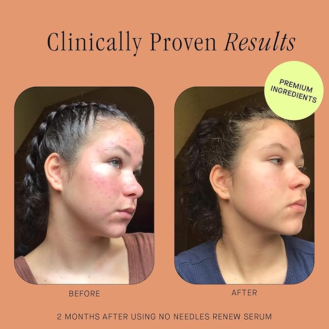 Brandefy No Needles - Niacinamide Serum, Peptides and Hyaluronic Acid. Hydrating & Plumping Serum for Bright, Smooth, Firm & Dewy Skin, 1oz, Made In The US