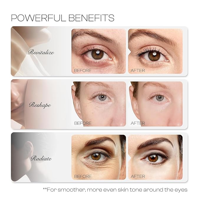 6% Caffeine Eye Cream: Dark Circle Remover Hydrating Anti-Wrinkle Eye Care Cream for Women 20ml 0.68fl.oz