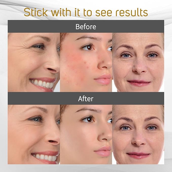 LED Face Mask Light therapy, FSA or HSA Eligible, Wireless Rechargeable Red Blue Light Therapy Mask Skincare Device, Facial Acne Light Therapy Mask