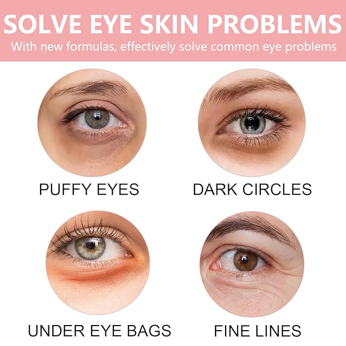 30 Pairs Lip Mask & Eye Mask,Under Eye Patches For Reducing Fine Lines & Dark Circles,Moisturizing Lip Spa Daily Labial Masks,Hydrating Adult Spa Party Favors Bridesmaid Gifts Birthday Gifts