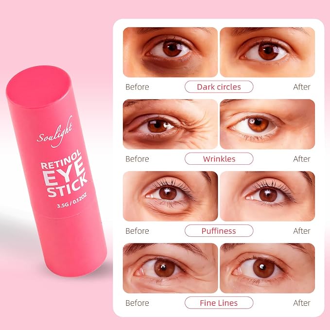 Soulight Retinol Eye Stick, Anti-Aging Eye Cream, Skincare for Wrinkles, Dark Circles, Puffiness - Retinol Eye Balm Moisturizes, Softens & Nourish Skin