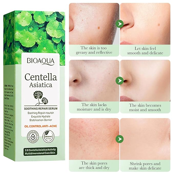 BIOAQUA Centella Asiatica Soothing Repair Facial Serum Nourish Oil Control Anti-Acne Face Skin Care 30ml / 1fl.oz