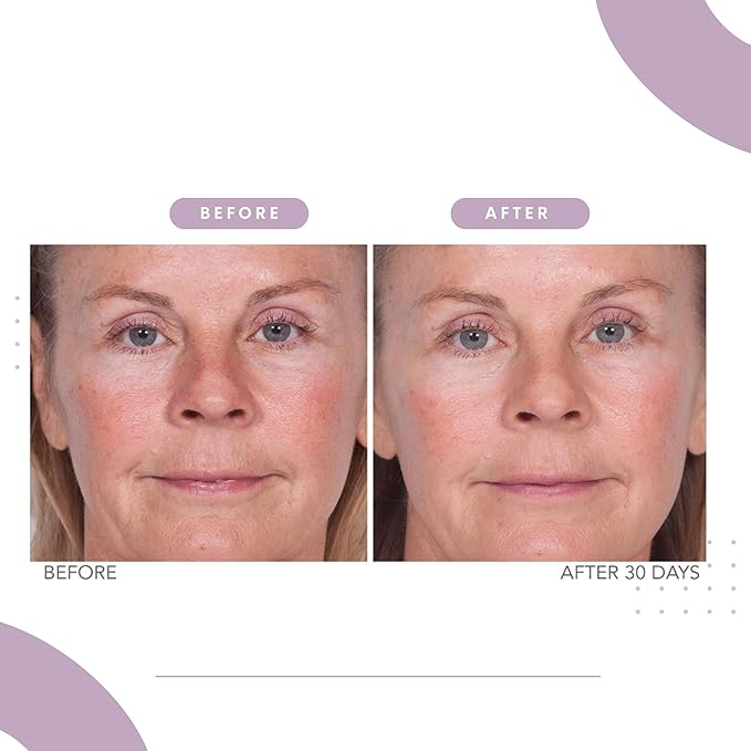 Serious Skincare Reverse Lift Firming Face Serum for Skin Tightening - Hydrating Anti-Aging Peptides - Lift & Firm Skin Care for Sagging Facial & Neck Contours - 1 Fl. Oz.