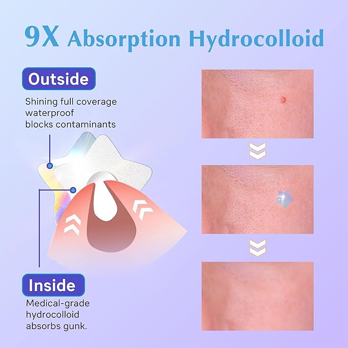 Hologram Pimple Patches for Face, Cute Hydrocolloid Acne Patches, Salicylic Acid & Tea Tree Colorful Star Spot Stickers,Zits & Blemish, Blue Cloud Zit Patches 12MM (48 Count)